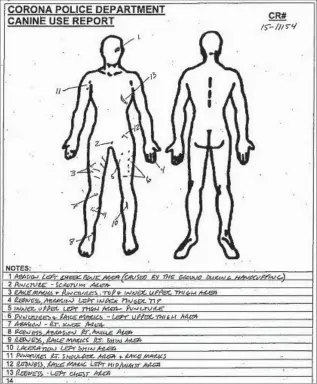  ??  ?? THE POLICE CANINE-USE REPORT shows the injuries Brandon Martin suffered during his apprehensi­on by Corona police. Martin punched and body-slammed the 79-pound dog.