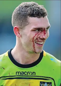  ?? REX ?? Blood and thunder: North suffered a nasty gash