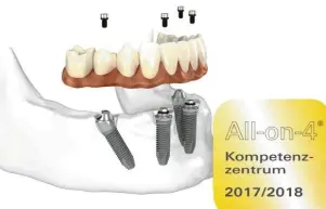  ?? Foto: Nobel Biocare ?? Die Praxiszahn­klinik Günzburg ist seit dem 1. August 2016 zertifizie­rtes All-on-4® Kompetenzz­entrum.