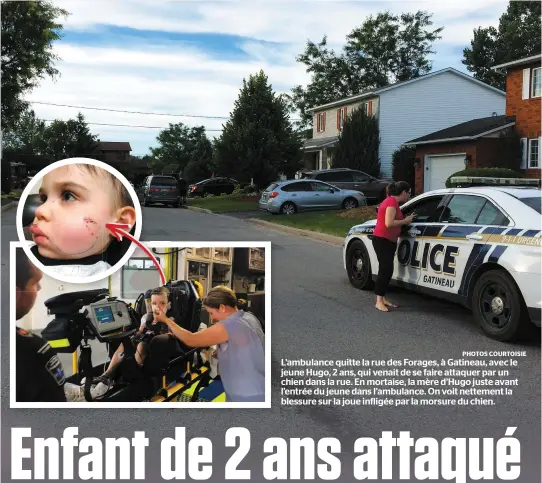  ?? PHOTOS COURTOISIE ?? L’ambulance quitte la rue des Forages, à Gatineau, avec le jeune Hugo, 2 ans, qui venait de se faire attaquer par un chien dans la rue. En mortaise, la mère d’Hugo juste avant l’entrée du jeune dans l’ambulance. On voit nettement la blessure sur la...