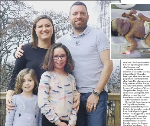  ??  ?? Ivy Cook, nine, front right, with her sister Olive, five, mum Emma and dad James; inset, Ivy when she was born with ichthyosis. STRONGER: