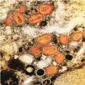  ?? NATIONAL INSTITUTE OF ALLERGY AND INFECTIOUS DISEASES ?? A transmissi­on electron micrograph of monkeypox particles.