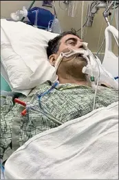  ?? PHOTO COURTESY OF MORENO ?? Dr. Shura Alexis Moreno spent almost five months in the hospital with both of his lungs damaged by COVID-19. He was intubated and put on a respirator — a machine that breathed for him.