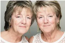  ??  ?? Spot the difference: 64-year-old twins Pauline (left) and Linda before and — right — after the makeovers