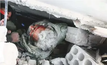  ?? AP ?? An injured man lies pinned under the rubble of a building in Ghouta. The enclave is home to 400,000 people.