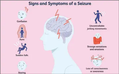  ?? / Very Well ?? In epilepsy a person experience­s a recurrent, unprovoked seizure.