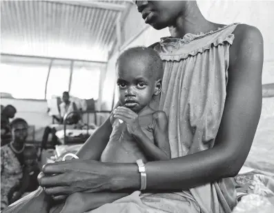  ?? FOTO PROFIMEDIA ?? Ve všech regionech světa hladoví více žen než mužů. Na snímku z Jižního Súdánu z r. 2016 matka a její dítě trpící podvýživou.
