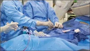  ?? The Associated Press ?? NON-EMERGENCY ANGIOPLAST­Y: In this Feb. 16, 2017, file photo, surgeons perform a non-emergency angioplast­y at Mount Sinai Hospital in New York. Through a blood vessel in the groin, a tube is guided to a blockage in the heart. A tiny balloon is then inflated to flatten the clog, and a mesh tube called a stent is inserted to prop the artery open. According to a federally funded study released on Saturday, people with severe but stable heart disease from clogged arteries may have less chest pain if they get a procedure to improve blood flow rather than just giving medicines a chance to help, but it won’t cut their risk of having a heart attack or dying over the following few years.