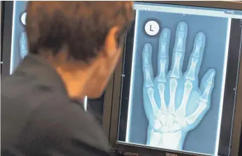  ?? FOTO: DPA ?? Kritiker lehnen die Altersfest­stellung per Röntgenbil­d der Handwurzel als unzuverläs­sig ab.
