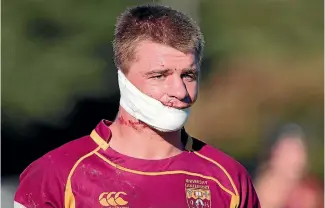  ?? PHOTO: JOSEPH JOHNSON ?? University captain Sam Godwin suffered a nasty facial injury which forced him off the field playing in a club rugby match this season in Christchur­ch .