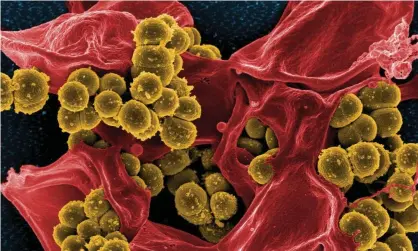  ??  ?? MRSA bacteria, one of the most common hospital superbugs. Photograph: Alamy