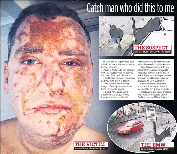  ??  ?? Andrew Walker shows his injuries Attacker caught on CCTV fleeing scene Suspect escapes in red BMW