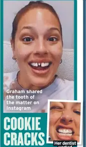  ??  ?? Graham shared the tooth of the matter on Instagram
Her dentist worked magic