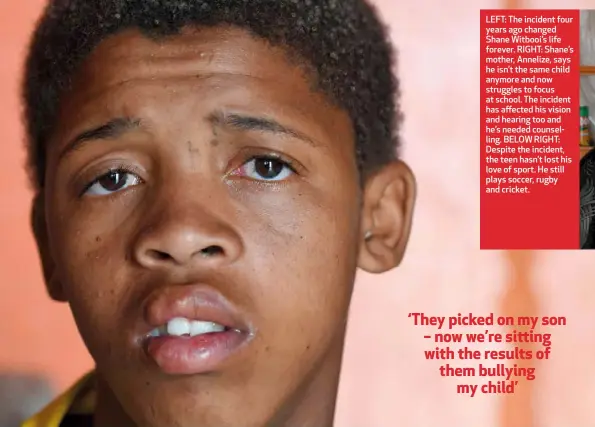  ??  ?? LEFT: The incident four years ago changed Shane Witbooi’s life forever. RIGHT: Shane’s mother, Annelize, says he isn’t the same child anymore and now struggles to focus at school. The incident has affected his vision and hearing too and he’s needed counsellin­g. BELOW RIGHT: Despite the incident, the teen hasn’t lost his love of sport. He still plays soccer, rugby and cricket.