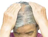  ?? DREAMSTIME ?? Menopause can bring on hair loss.