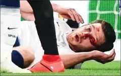  ?? BT SPORT/REX ?? Horror injury: Vertonghen with blood on his eye and (top) flat out on the floor after the collision