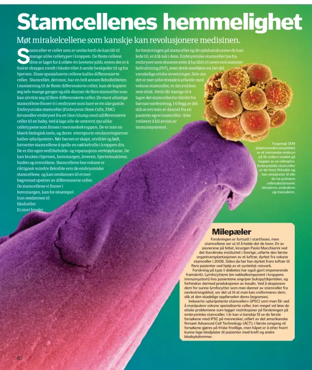  ??  ?? Fargelagt SEM ( elektronmi­kroskopbil­de) av et menneske- embryo på 16- cellers- stadiet på tuppen av en nålespiss. Embryonisk­e stamceller er de mest fleksible og kan omdannes til alle
de tre primære cellesubst­ansene: ektoderm, endoderm
og mesoderm.