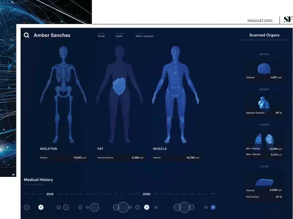  ??  ?? The QBio scanner would take measuremen­ts of your body every year, and then flag up any changes that could be a cause for concern