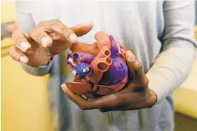  ?? KIM HAIRSTON/BALTIMORE SUN ?? Dr. Carissa Baker-Smith is a pediatric cardiologi­st with the University of Maryland Medical Center who helped a baby with two congenital heart defects using 3D printing technology. Baker-Smith looks at a recent 3D-printed model of the girl’s heart, made larger than the actual size. A similar model helped doctors understand the best approach for her surgery.