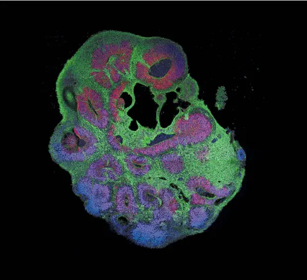  ??  ?? Ein Organoid-Querschnit­t mit Stammzelle­n in Rot, Neuronen in Grün.
