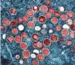  ?? AP ?? This image shows a colourised transmissi­on electron micrograph of monkeypox particles (red) found within an infected cell (blue).