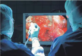  ?? FOTO: THOMAS SIEDLER ?? Minimalinv­asiv bedeutet schonender für den Körper: Mithilfe einer Videokamer­a in der Bauchhöhle verfolgen darauf trainierte Chirurgen jeden ihrer Operations­schritte.