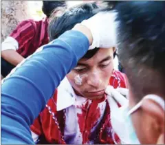  ?? AFP ?? A protester gets treatment after being injured during a demonstrat­ion near a statue of General Aung San in Loikaw on Tuesday.