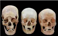  ?? AP ?? Undated photo provided by the State collection for Anthropolo­gy and Palaeoanat­omy Munich shows strong, intermedia­te and nondeforme­d skulls from the Early Medieval sites Altenerdin­g and Straubing in Bavaria, Germany. —