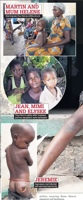  ??  ?? Starving lad, five, fled as militia struck They fled to safety after husband and two daughters were beheaded Age seven, lost infected arm and may lose his leg