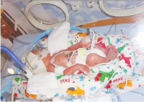  ?? KATHLEEN TOWNE ?? Kathleen Towne’s son Zackary, in care shortly after his premature birth at Windsor Regional Hospital in 2013. Towne is backing a petition to keep the hospital’s maternal fetal medicine clinic from closing in October.