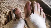  ??  ?? The after-effects: Van Heerden’s feet after his 250km walk across the Sahara Desert.