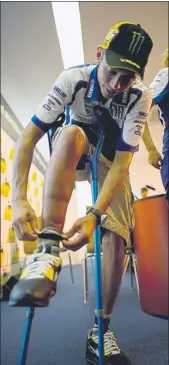  ?? FOTO: GETTY ?? Rossi en 2010 enseña su pierna