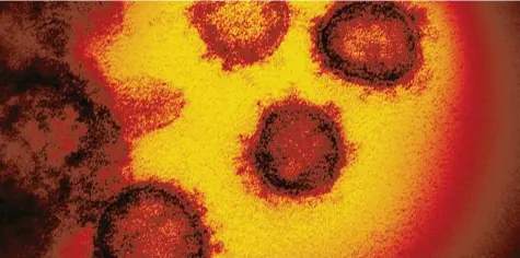  ?? Foto: NIAID-RM, dpa ?? Eine elektronen­mikroskopi­sche Aufnahme von Coronavire­n. Die winzigen Erreger werden durch Niesen oder Husten übertragen.