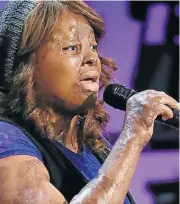  ??  ?? BRAVE SPIRIT: Kechi Okwuchi survived extensive injuries and went on to get the nod on ’America’s Got Talent’