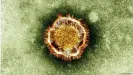  ??  ?? The SARS virus belongs to the corona viruses.