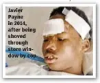  ??  ?? Javier Payne in 2014, after being shoved through store window by cop.