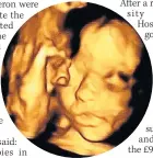  ??  ?? 3D IMAGE Colour scan of foetus