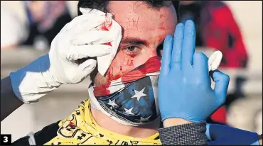  ?? PHOTOS AFP ?? 3
1. Une importante force policière a été déployée dans les rues de la capitale fédérale.
2. Au moins 10 000 personnes ont défilé dans les rues de Washington pour dénoncer les résultats de la présidenti­elle. 3. Un partisan du président Donald Trump reçoit des soins après avoir été blessé par un assaillant inconnu.