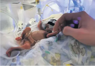 ??  ?? Tiny tot Baby Sofia weighed just 500g when she was born but is now home with parents