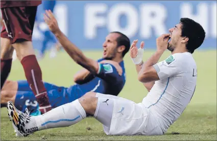  ?? RICARDO MAZALAN/ASSOCIATED PRESS ?? Luis Suarez (above) holds his teeth but Giorgio Chiellini (below) has marks to show after a collision involving the two.