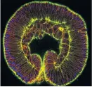 ?? Foto: Sabrina Kaul-Strehlow, Patrick Steinmetz ?? Frühes Embryonals­tadium einer Seeanemone mit Einstülpun­gen.
