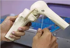  ?? [ FOTO NIK HARIFF HASSAN/BH] ?? Noorirwand­y menunjuk cara penggunaan produk pembaikan ACL pada tulang.