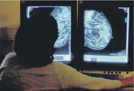  ??  ?? A consultant studying a mammogram. Picture by PA Wire/PA Images