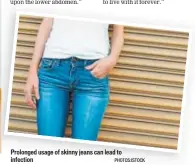  ?? PHOTOS:ISTOCK ?? Prolonged usage of skinny jeans can lead to infection