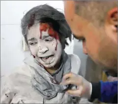  ?? AMER ALMOHIBANY/AFP ?? A Syrian girl receives treatment as victims of reported regime airstrikes are brought to a makeshift hospital in the rebel-held enclave of Eastern Ghouta on Wednesday.