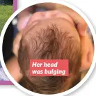  ??  ?? Her head was bulging