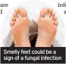  ??  ?? Smelly feet could be a sign of a fungal infection