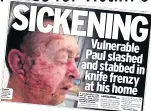  ??  ?? SHOCK REPORT How we broke the story of attack on Paul