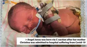  ??  ?? > Angel Jones was born via C-section after her mother Christina was admitted to hospital suffering from Covid-19