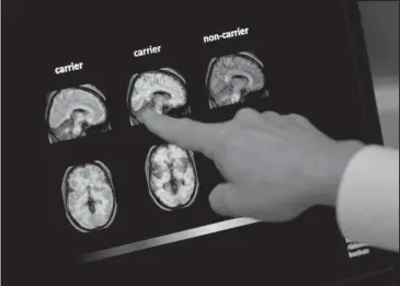  ?? The Associated Press ?? BRAIN SCAN: Dr. William Burke goes over a PET brain scan on Aug. 14 at Banner Alzheimers Institute in Phoenix. It may be too late to stop Alzheimer’s in people who already have some mental decline but Banner is conducting two studies that target the very earliest brain changes while memory and thinking skills are still intact in hope of preventing the disease.